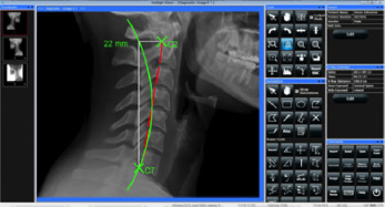 Digital X-Ray Software Screen