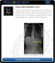 Angle Measurement Tool