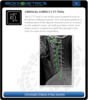 Cervical Curve C1-T1 Tool