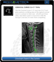 Cervical Curve C2-C7 Tool