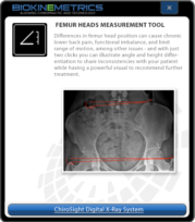 Femur Heads Measurement Tool