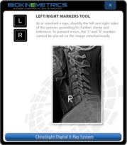 Left/Right Markers Tool