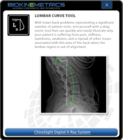 Lumbar Curve Tool