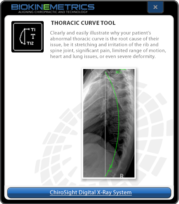 Thoracic Curve Tool
