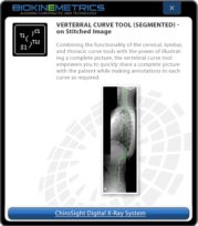 Vertebral Curve Tool (Segmented)