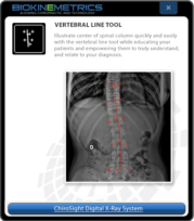 Vertebral Line Tool